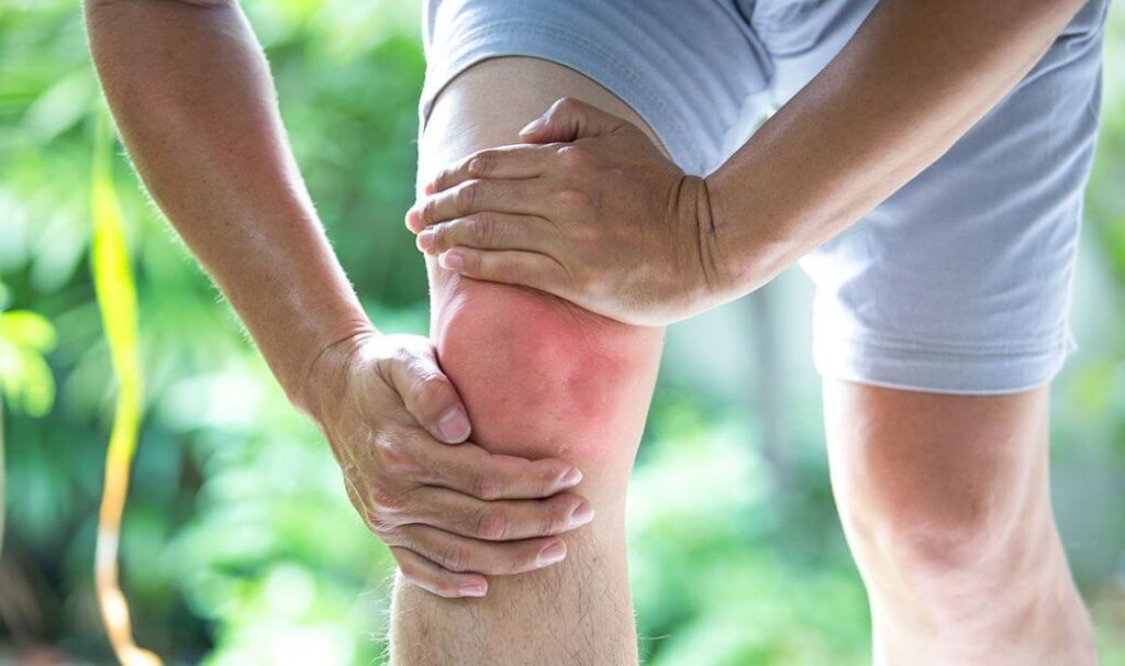 Melhores Suplementos para Artrose